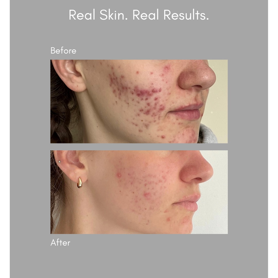 SKINICIAN image ad example