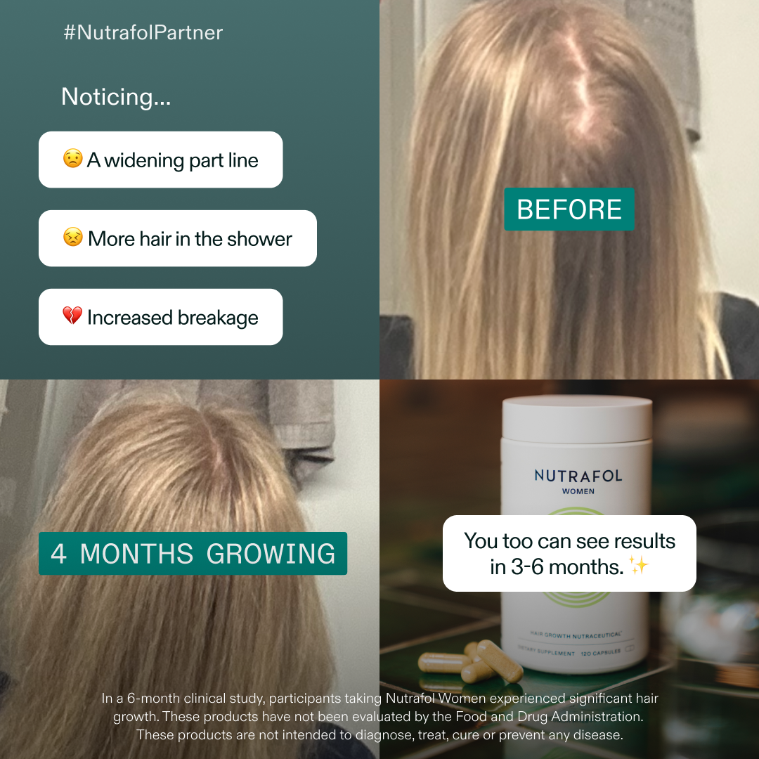 Nutrafol image ad — Get your hair confidence back.