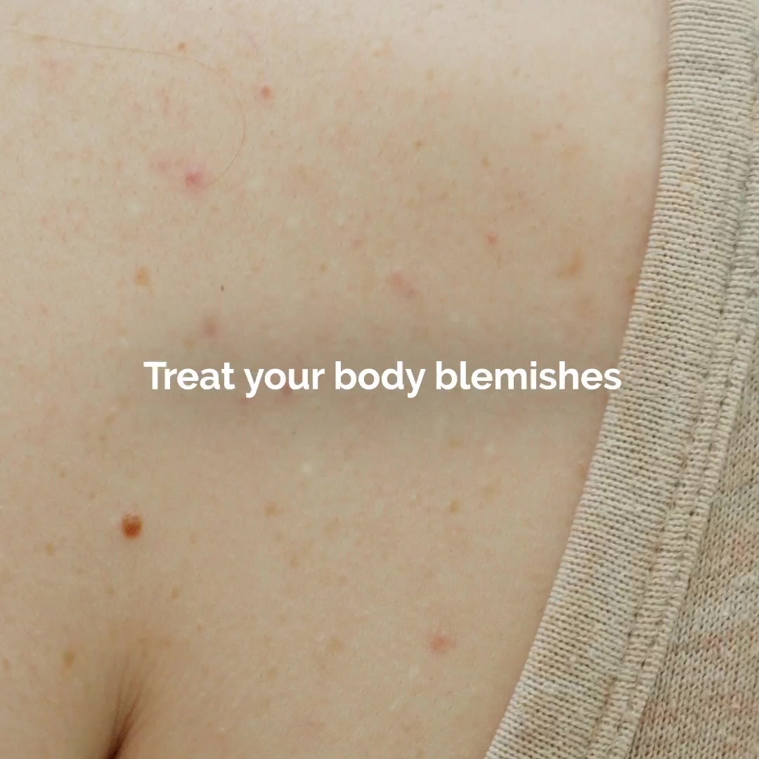 The Ordinary video ad — Smooth Skin Approved.