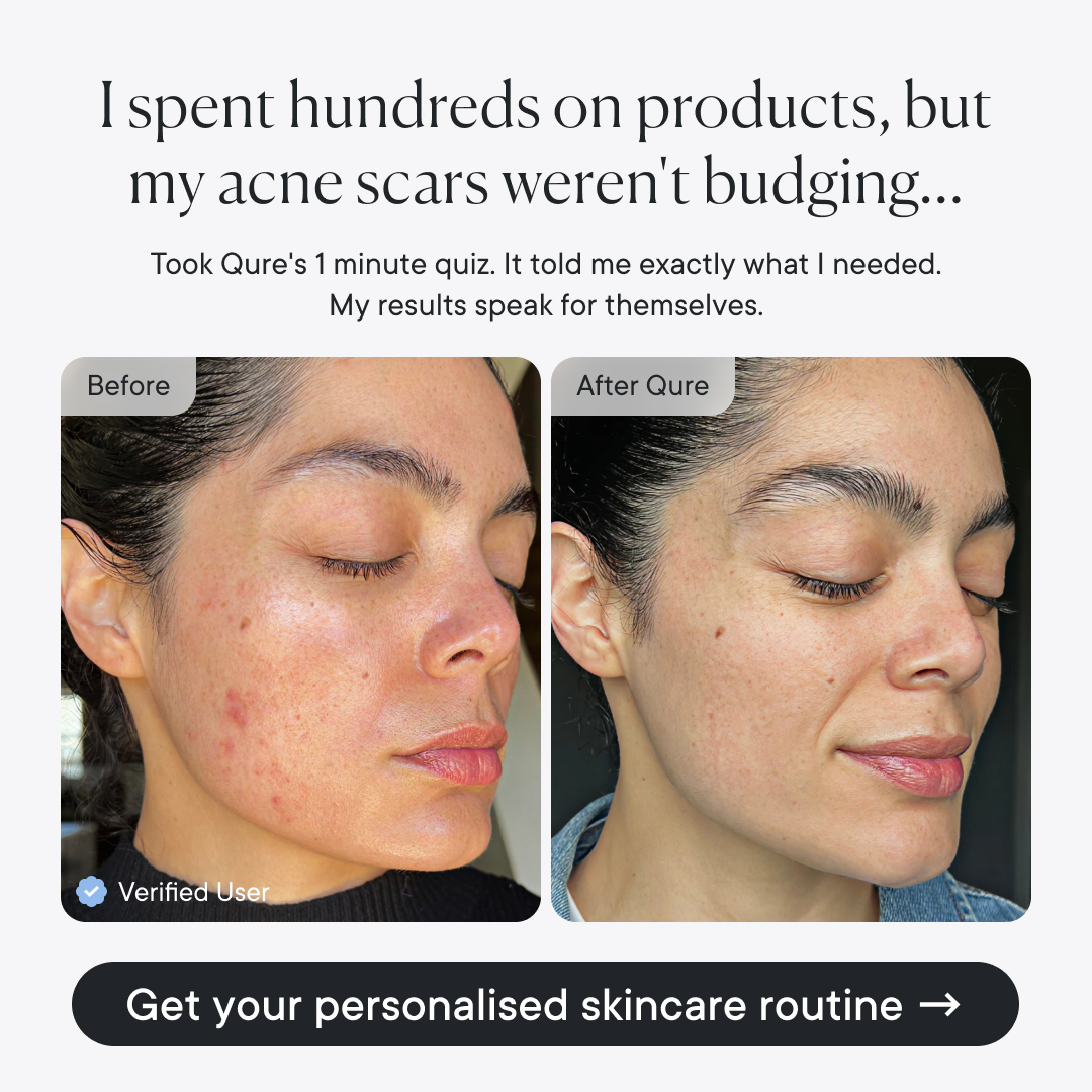 Qure Skincare image ad example